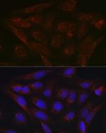 PDK4 Antibody in Immunocytochemistry (ICC/IF)