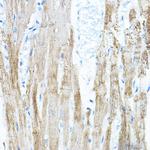 PDK4 Antibody in Immunohistochemistry (Paraffin) (IHC (P))