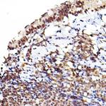 Phospho-AKT1/AKT2/AKT3 (Ser473) Antibody in Immunohistochemistry (Paraffin) (IHC (P))