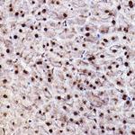 Phospho-AKT1/AKT2/AKT3 (Ser473) Antibody in Immunohistochemistry (Paraffin) (IHC (P))