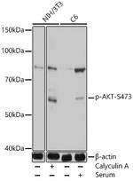 Phospho-AKT1/AKT2/AKT3 (Ser473) Antibody in Western Blot (WB)