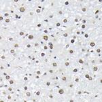 Phospho-FOXO1/FOXO3/FOXO4 (Thr24, Thr32, Thr28) Antibody in Immunohistochemistry (Paraffin) (IHC (P))