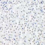 Phospho-FOXO1/FOXO3/FOXO4 (Thr24, Thr32, Thr28) Antibody in Immunohistochemistry (Paraffin) (IHC (P))