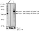 Phospho-FOXO1/FOXO3/FOXO4 (Thr24, Thr32, Thr28) Antibody in Western Blot (WB)