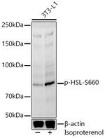 Phospho-HSL (Ser660) Antibody in Western Blot (WB)