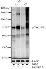 Phospho-TAK1 (Ser412) Antibody in Western Blot (WB)