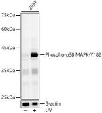 Phospho-p38 MAPK alpha (Tyr182) Antibody in Western Blot (WB)