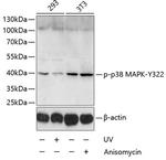 Phospho-p38 MAPK (Tyr322) Antibody in Western Blot (WB)