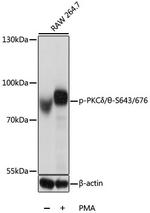 Phospho-PKC delta/theta (Ser643, Ser676) Antibody in Western Blot (WB)