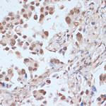 Phospho-AMPK alpha-1,2 (Thr183, Thr172) Antibody in Immunohistochemistry (Paraffin) (IHC (P))