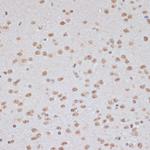 Phospho-AMPK alpha-1,2 (Thr183, Thr172) Antibody in Immunohistochemistry (Paraffin) (IHC (P))