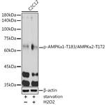 Phospho-AMPK alpha-1,2 (Thr183, Thr172) Antibody in Western Blot (WB)