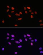 Phospho-SMAD2/SMAD3 (Ser465, Ser467, Ser423, Ser425) Antibody in Immunocytochemistry (ICC/IF)