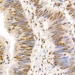 Phospho-SMAD2/SMAD3 (Ser465, Ser467, Ser423, Ser425) Antibody in Immunohistochemistry (Paraffin) (IHC (P))