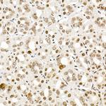 Phospho-SMAD2/SMAD3 (Ser465, Ser467, Ser423, Ser425) Antibody in Immunohistochemistry (Paraffin) (IHC (P))