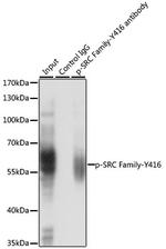 Phospho-LCK/FYN (Tyr416) Antibody in Immunoprecipitation (IP)