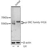 Phospho-LCK/FYN (Tyr416) Antibody in Western Blot (WB)