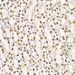 Phospho-STAT6 (Tyr641) Antibody in Immunohistochemistry (Paraffin) (IHC (P))