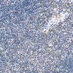 Phospho-STAT6 (Tyr641) Antibody in Immunohistochemistry (Paraffin) (IHC (P))