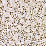 Phospho-STAT6 (Tyr641) Antibody in Immunohistochemistry (Paraffin) (IHC (P))