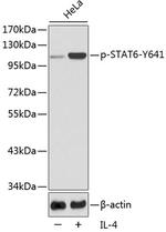 Phospho-STAT6 (Tyr641) Antibody in Western Blot (WB)