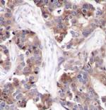 Phospho-Stathmin 1 (Ser25) Antibody in Immunohistochemistry (Paraffin) (IHC (P))