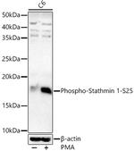 Phospho-Stathmin 1 (Ser25) Antibody in Western Blot (WB)