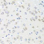 PIAS3 Antibody in Immunohistochemistry (Paraffin) (IHC (P))