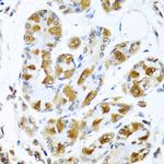 PIAS3 Antibody in Immunohistochemistry (Paraffin) (IHC (P))