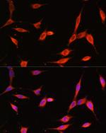 PI3K p55 gamma Antibody in Immunocytochemistry (ICC/IF)