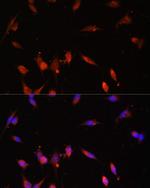 PI3K p55 gamma Antibody in Immunocytochemistry (ICC/IF)