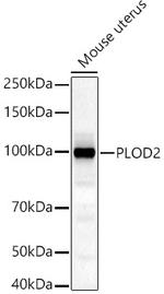 PLOD2 Antibody in Western Blot (WB)