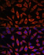 POGLUT1 Antibody in Immunocytochemistry (ICC/IF)