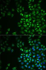 POLG2 Antibody in Immunocytochemistry (ICC/IF)