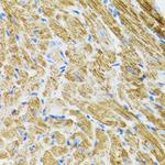 POLG2 Antibody in Immunohistochemistry (Paraffin) (IHC (P))