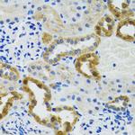 POLG2 Antibody in Immunohistochemistry (Paraffin) (IHC (P))