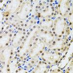 POP4 Antibody in Immunohistochemistry (Paraffin) (IHC (P))