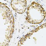 POP4 Antibody in Immunohistochemistry (Paraffin) (IHC (P))