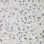 POP4 Antibody in Immunohistochemistry (Paraffin) (IHC (P))