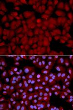 PPP1CB Antibody in Immunocytochemistry (ICC/IF)