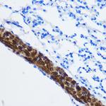 PPP1CB Antibody in Immunohistochemistry (Paraffin) (IHC (P))