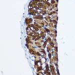 PPP1CB Antibody in Immunohistochemistry (Paraffin) (IHC (P))