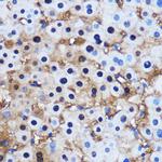 PPP1CB Antibody in Immunohistochemistry (Paraffin) (IHC (P))