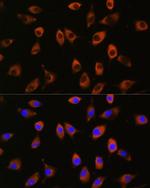 PPP1R9B Antibody in Immunocytochemistry (ICC/IF)