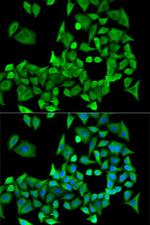 PPP2R1A Antibody in Immunocytochemistry (ICC/IF)