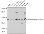 PPP2R1A Antibody in Western Blot (WB)