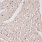 PRPF31 Antibody in Immunohistochemistry (Paraffin) (IHC (P))