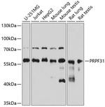 PRPF31 Antibody in Western Blot (WB)