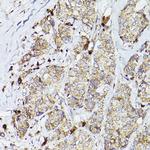 PSAP Antibody in Immunohistochemistry (Paraffin) (IHC (P))