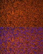 PTCH Antibody in Immunocytochemistry (ICC/IF)